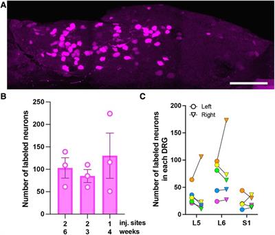 AAV-mediated gene transfer to colon-innervating primary afferent neurons